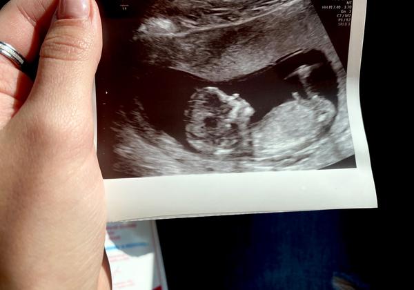 Holka nebo kluk😁. Co myslíte?