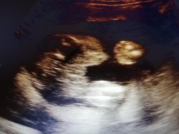 Pohlaví miminka. Poznáte někdo z fotky?