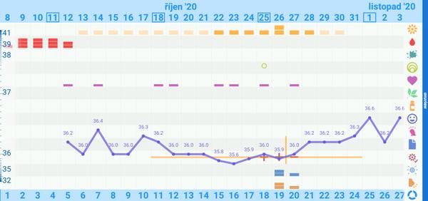 Prosím o radu - Graf BT. Zkušenosti?