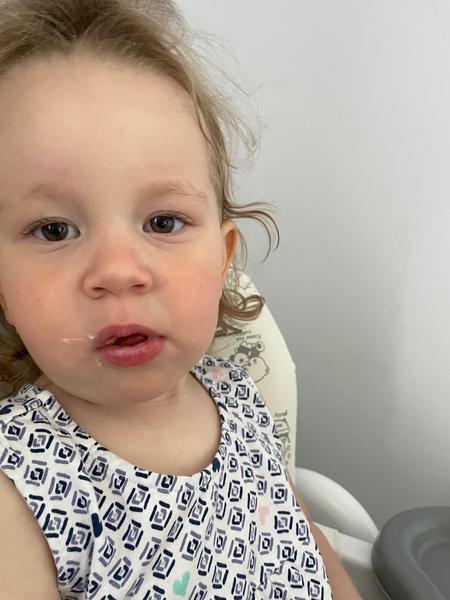 Bílý povlak a chrapot. Může jít o moučnivku?