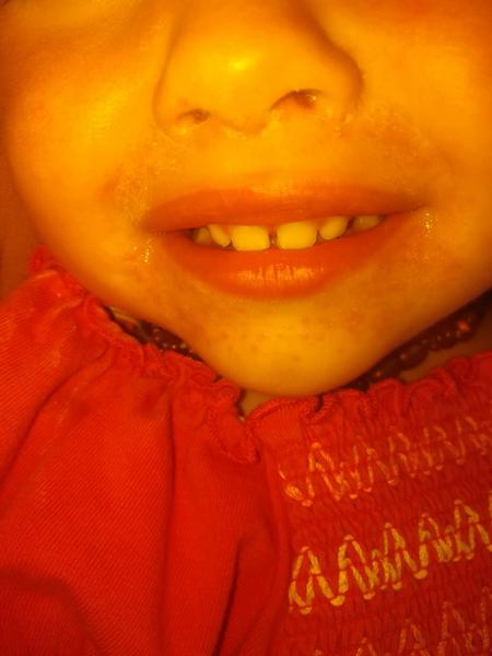 Atopický ekzém? Kvasinky? Co by to mohlo být?