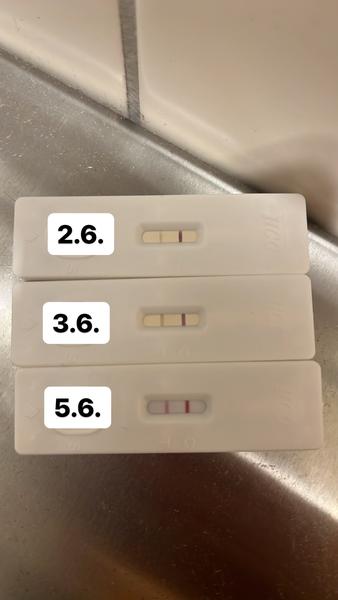 Roste tetovací čárka správně? Zkušené oko poradí!