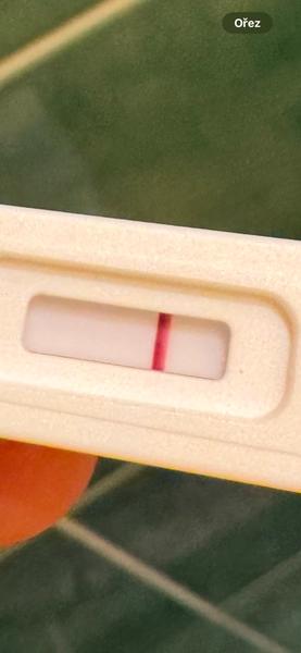 Negativní testy. Čím by to tedy mohlo být, když mě trápí pocit nafouklého podbřišku, břicha, častější čůrání?