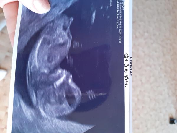 Holčička nebo chlapeček? Poznáte pohlaví?