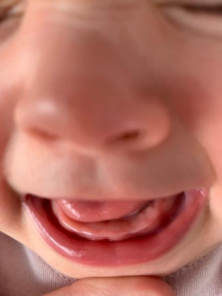 Zuby. Mohlo by to být tím?