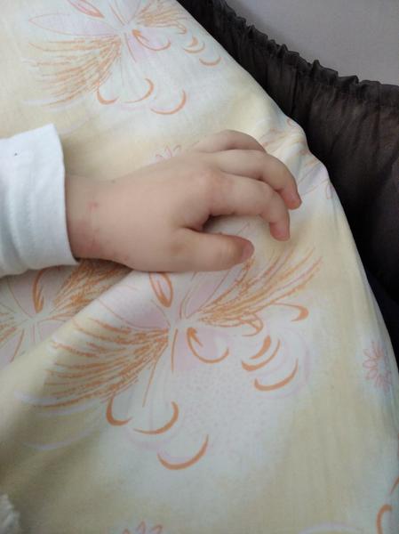 Svědivá vyrážka. Co by to mohlo být?