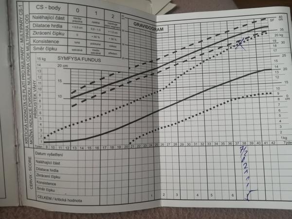 Těhotenská průkazka, pojmy.