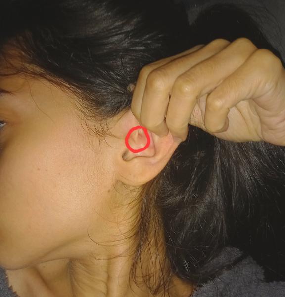 Co znamená boule uvnitř ucha? Diagnóza a řešení