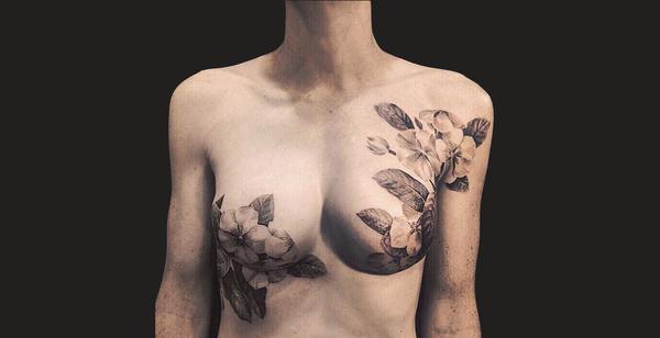 Chtějí muži ženu po mastektomii prsů, s implantáty?