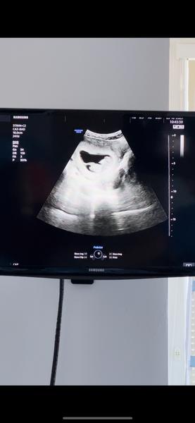 Pohlaví dítěte. Lze určit?