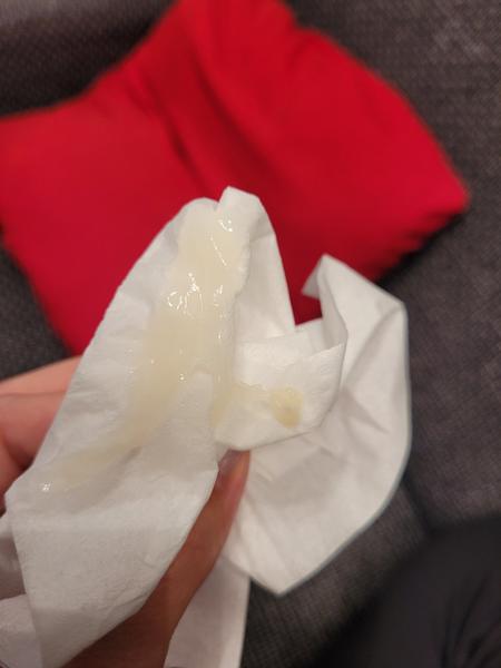 Může to být hlenová zátka?