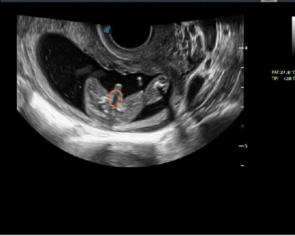 Na utz kluk. Může z toho být holka?