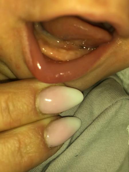 Může slintání dvouměsíčního dítěte znamenat růst zubů?