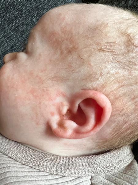 Mohlo by se jednat o seboreu?