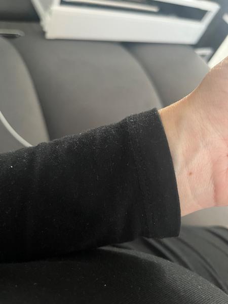 Boulička na zápěstí: Je to ganglion? Kam se vydat?