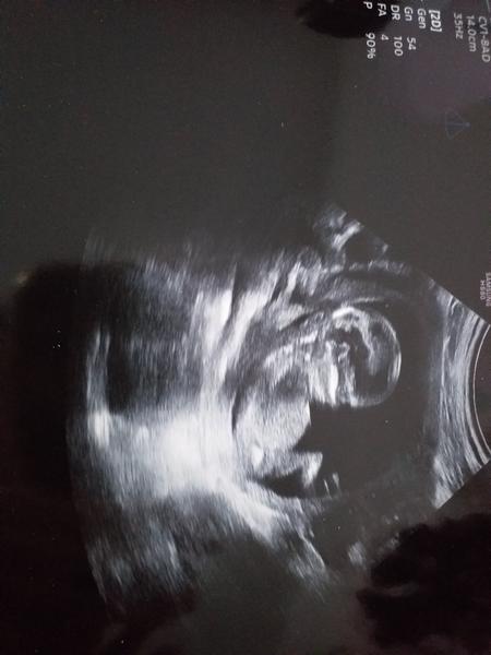 Pohlaví podle utz z 15.tt. Co byste holky řekly?