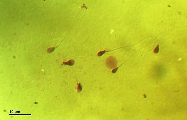 Lidské spermie Lidské spermie