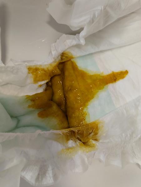 Kojené dítě. Má mít kyselou a hlenovitou stolici?