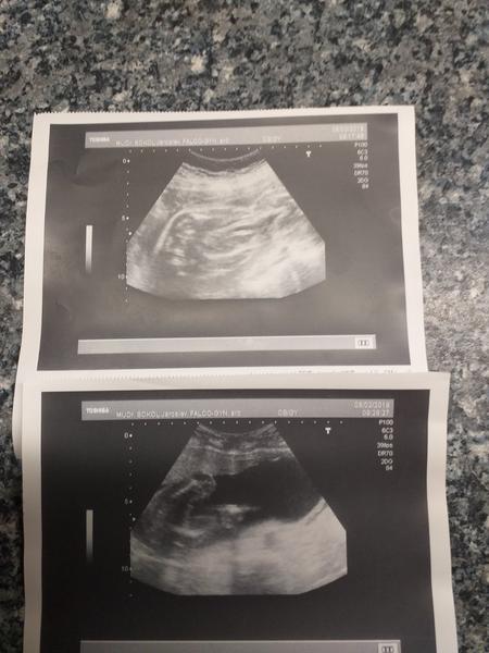 Nějaká zkušenost, že by se v Gennetu sekli z určením pohlaví?