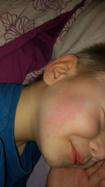 Reakce na krém Garnier?