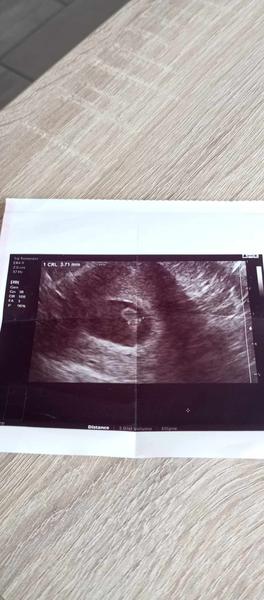 Je přesnost těhotenských testů ovlivněna termínem poslední menstruace?