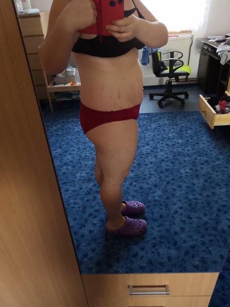 Je normální mít takhle velké břicho na začátku 11. týdne?