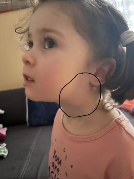 Zvětšená uzlina na krku u dítěte: Příběh a diagnóza