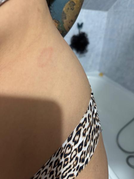 Flek. Co by to mohlo být?