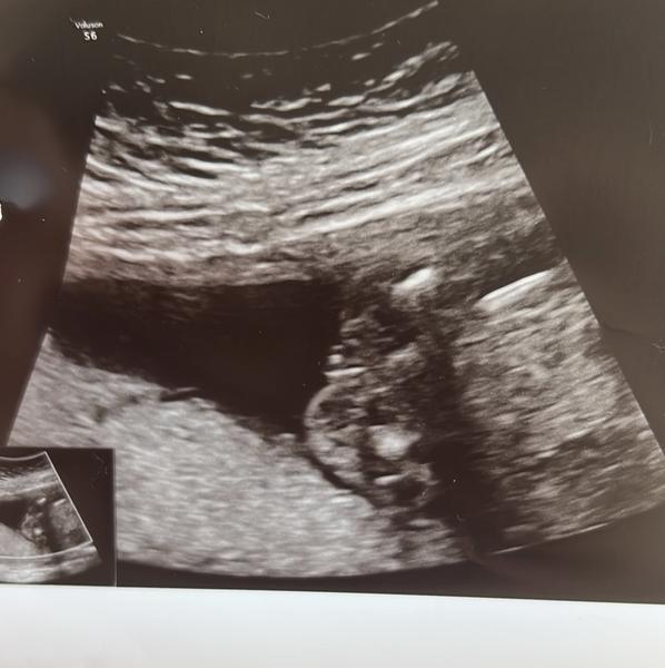 Vidíte kačenu v našem novém diskusním fóru?