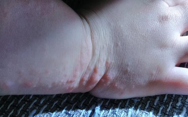 Pupínky. Co by to mohlo být?