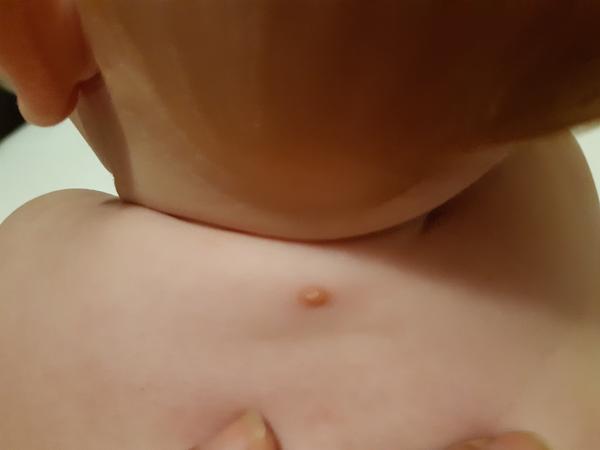 Skvrny. Co by to mohlo být?