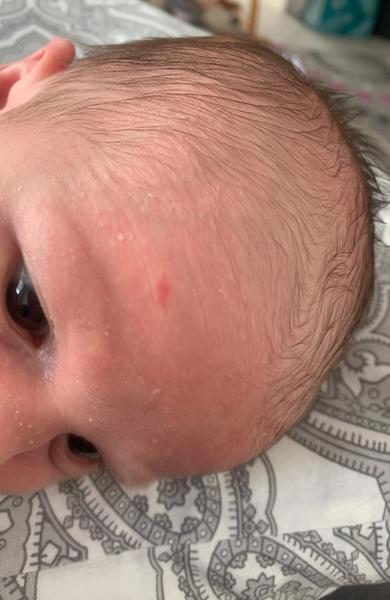 Červené flíčky. Mám plašit?