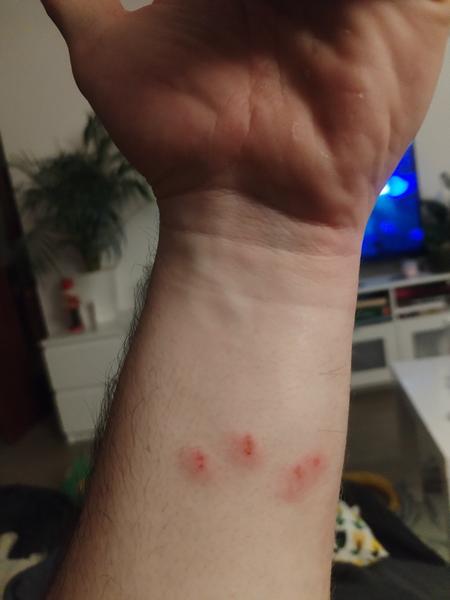 Od čeho může být kousnutí?