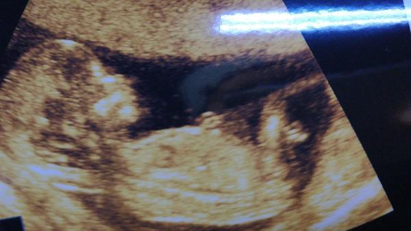 Holka nebo kluk. Je poznat pohlaví?