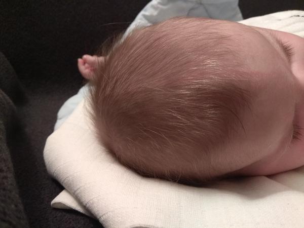 Červená čára na hlavičce kojence