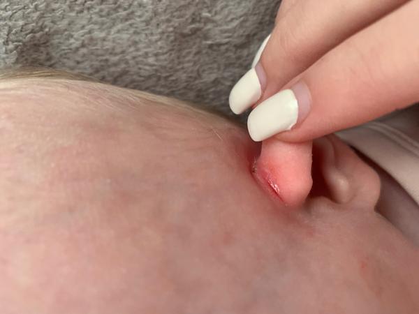 Zarudlá mokvající plocha za ouškem - co to je a co pomůže?