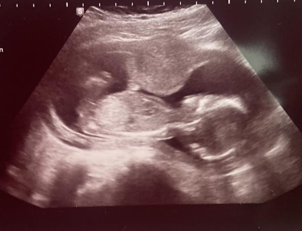 Jak uhodnout pohlaví dítěte bez lékařského odhalení?