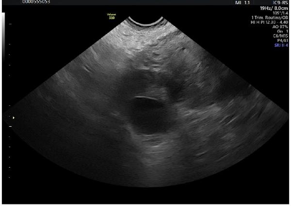 Čtení na ultrazvuku. Co mohu vidět?