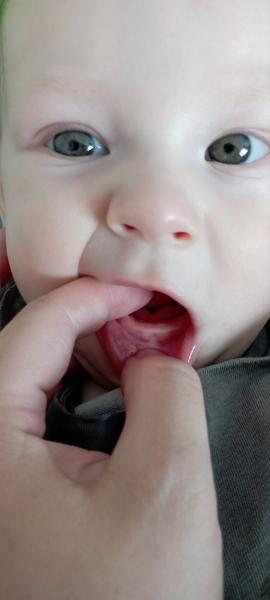 Může být protivnost a slinění znakem růstu zubů?