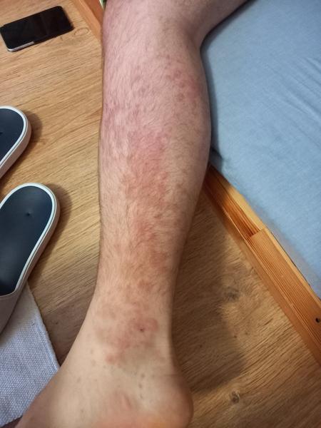 Kdy vyhledat lékařskou pohotovost? Zjištění příznaků nemoci u manžela.