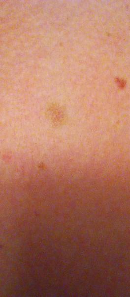 Piha. Proč je takto ohraničená?