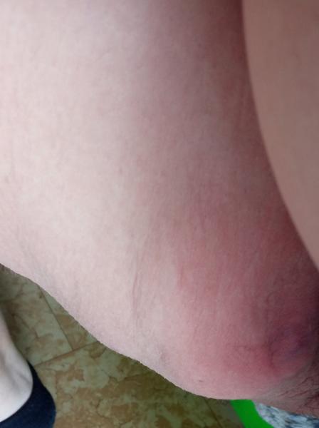 Boule v tříselné oblasti ve 37. týdnu těhotenství?