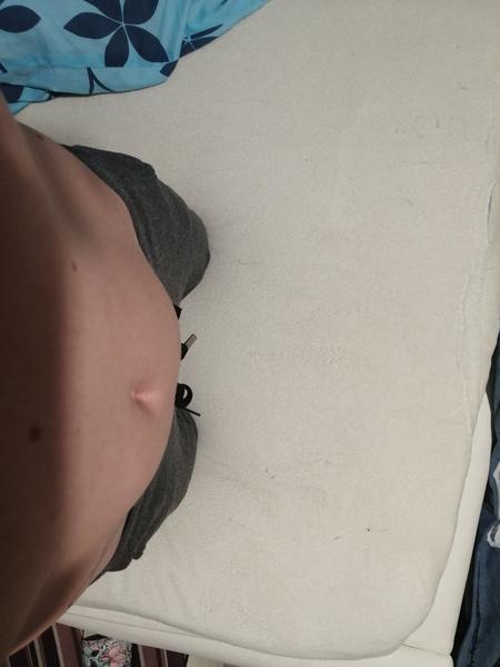 Jedna část bříška větší než ta druhá. Nesetkala jste se s tím některá?