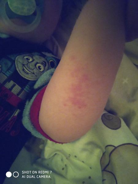 Průjem už týden. Co by to mohlo být?