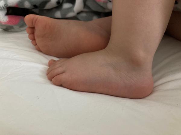 Výbava na léto. Jaké botičky pořídit?