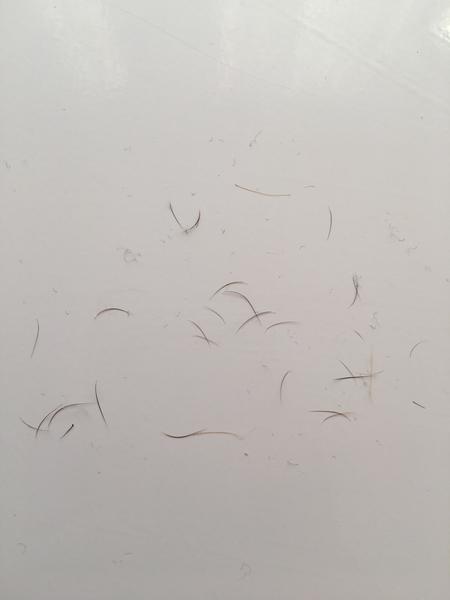 Padání ochlupení. Mát podobnou zkušenost?