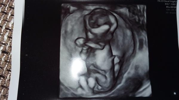 Tak, jaké vidíte pohlaví? 🙂