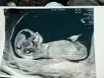 12. týden těhotenství. Poznáte pohlaví?