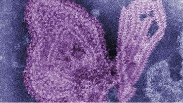 Virus příušnic pod mikroskopem