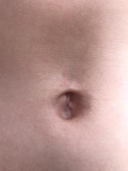 Piercing do pupíku a tipy na výběr vhodného pupíku